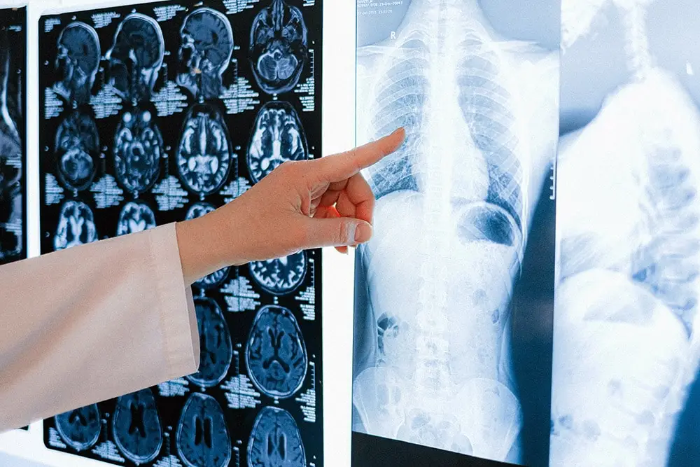 astma: Pani doktor wskazuje ręką na rentgen płuc wiszący na ścianie