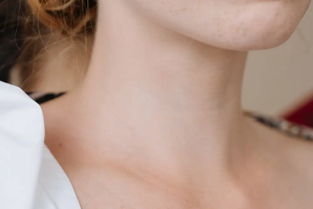 Hyperthyroidism: Lady's neck