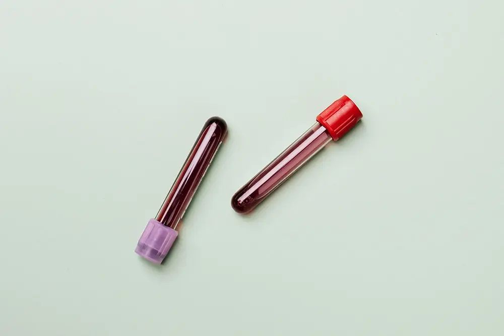Plasma of COVID-19 healers