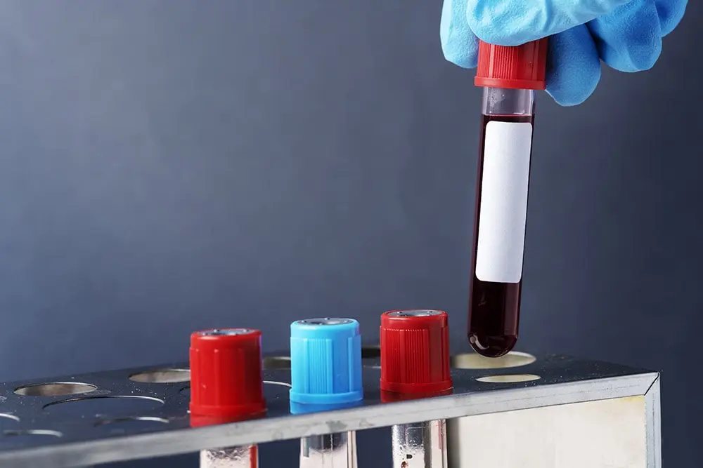 Hemophilia - the most important information