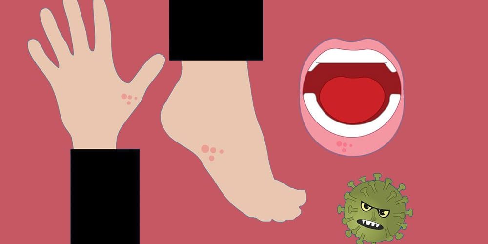 Świerzb: graficzny rysunek nogi, ręki, ust