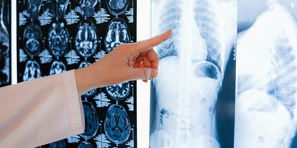 astma: Pani doktor wskazuje ręką na rentgen płuc wiszący na ścianie