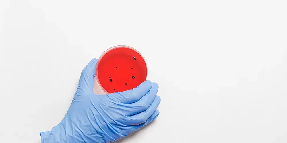 The hand of a doctor in a blue glove holds a container with bacterial flora