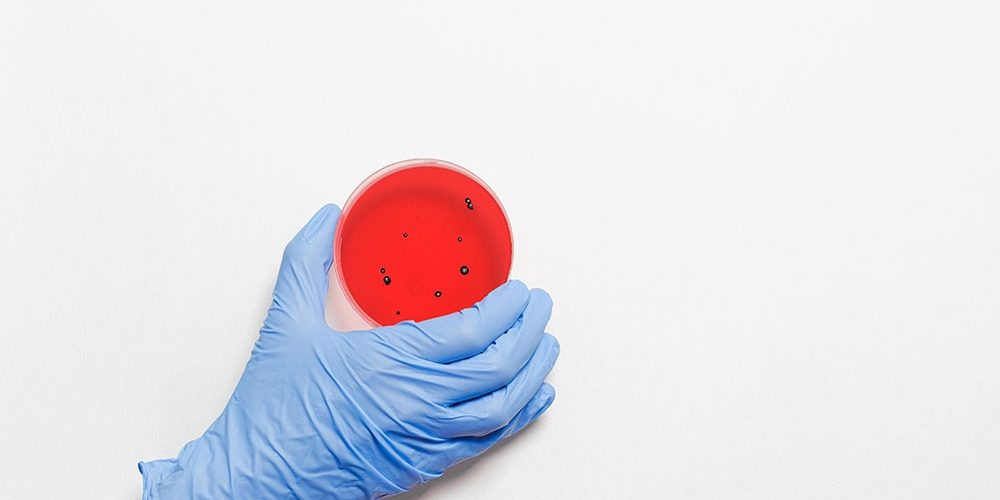 Ręka lekarza w niebieskiej rękawiczce trzyma pojemnik z flora bakteryjna