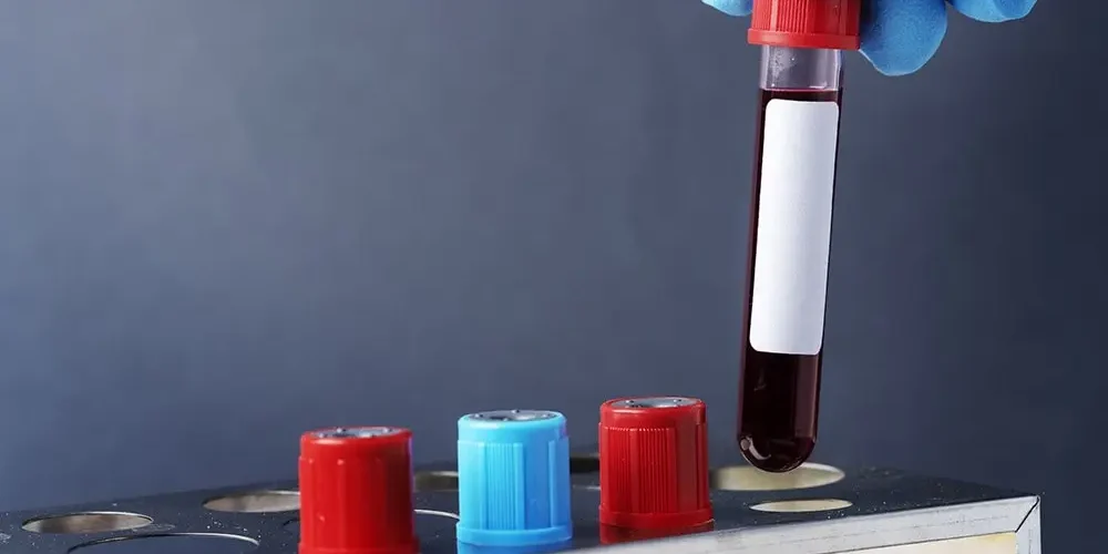 Hemophilia - the most important information