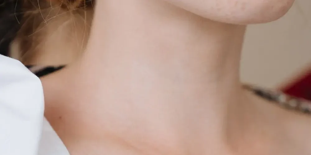 Hyperthyroidism: Lady's neck
